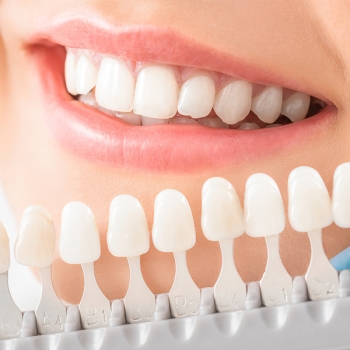 Cosmetic Dentistry Service in Tarro