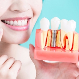 Dental Implants Service in Tarro