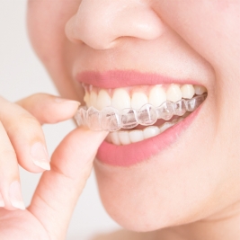 Invisalign clear Aligners Service in Woodberry