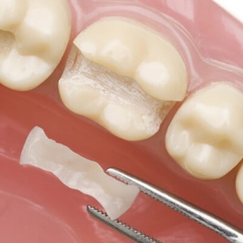 Restorative Dentistry Service in East Maitland