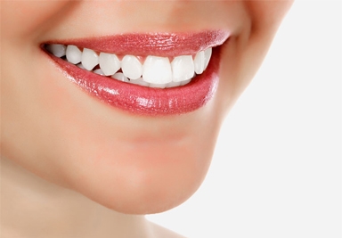 Smile Makeover Service in Tarro