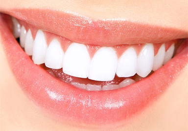 Teeth Whitening Service in Tarro