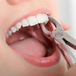 Tooth Extraction Service in Gilleston Heights